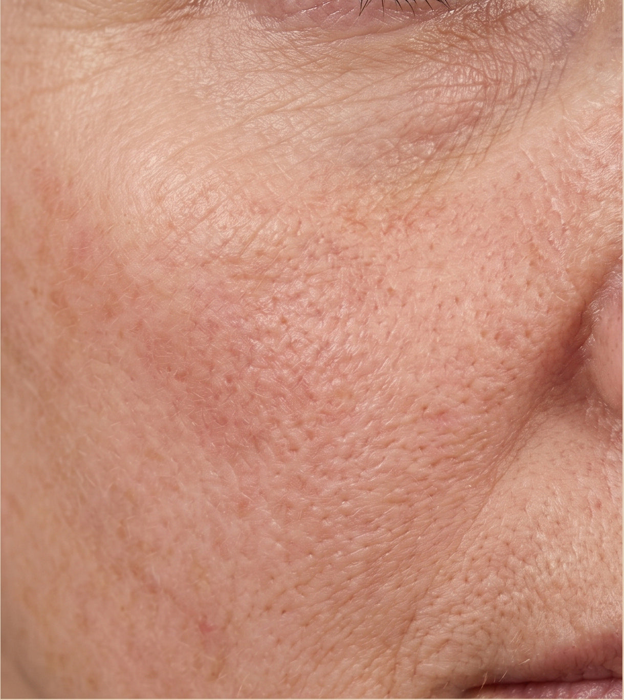 Before image